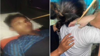 Ngeri! Panah Tertancap di Mata Pemuda Tallo, Perempuan Juga Terluka