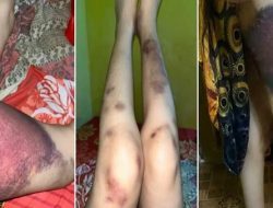 Sadis! IRT Hamil Lima Bulan Ditendang Membabi Buta, Pelaku Diduga Merasa Kebal Polisi