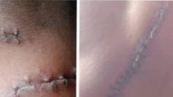 Kasus Penganiayaan Brutal di Takalar Uji Nyali Penegak Hukum