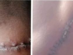 Kasus Penganiayaan Brutal di Takalar Uji Nyali Penegak Hukum