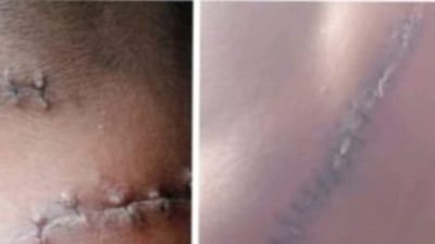 Kasus Penganiayaan Brutal di Takalar Uji Nyali Penegak Hukum