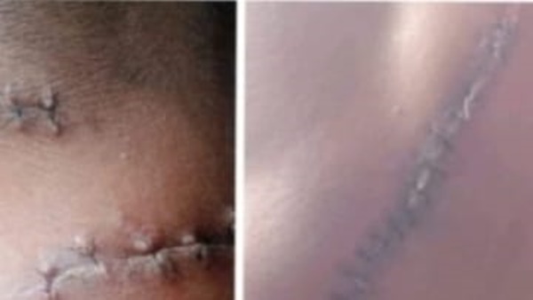 Kasus Penganiayaan Brutal di Takalar Uji Nyali Penegak Hukum