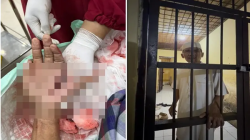 Sadis di Jeneponto, Tokoh Penolak Prostitusi Ditebas Brutal hingga Tangan Hampir Putus