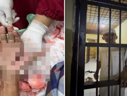 Sadis di Jeneponto, Tokoh Penolak Prostitusi Ditebas Brutal hingga Tangan Hampir Putus